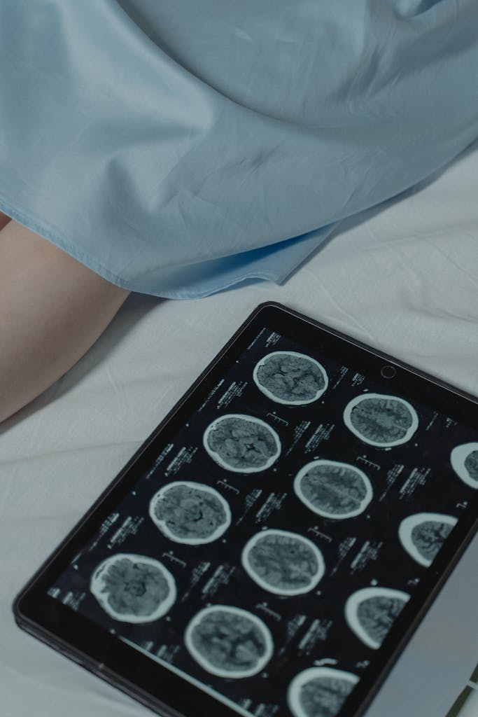 Close-up of a digital tablet showing brain scans next to patient in a hospital setting.