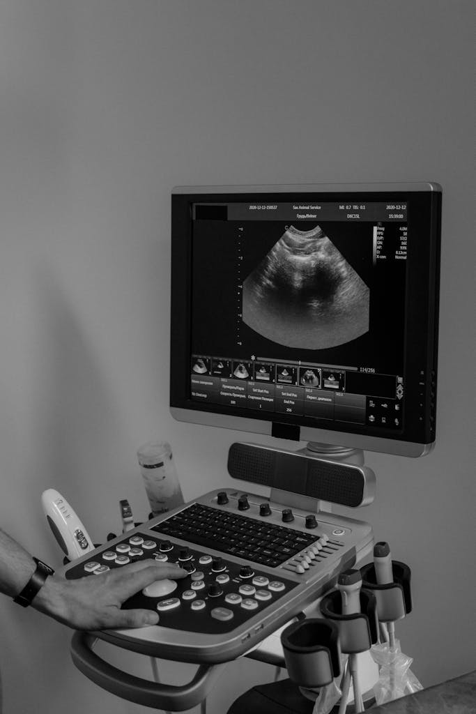 Close-up of a grayscale ultrasound machine in use, showing medical imaging on the screen.