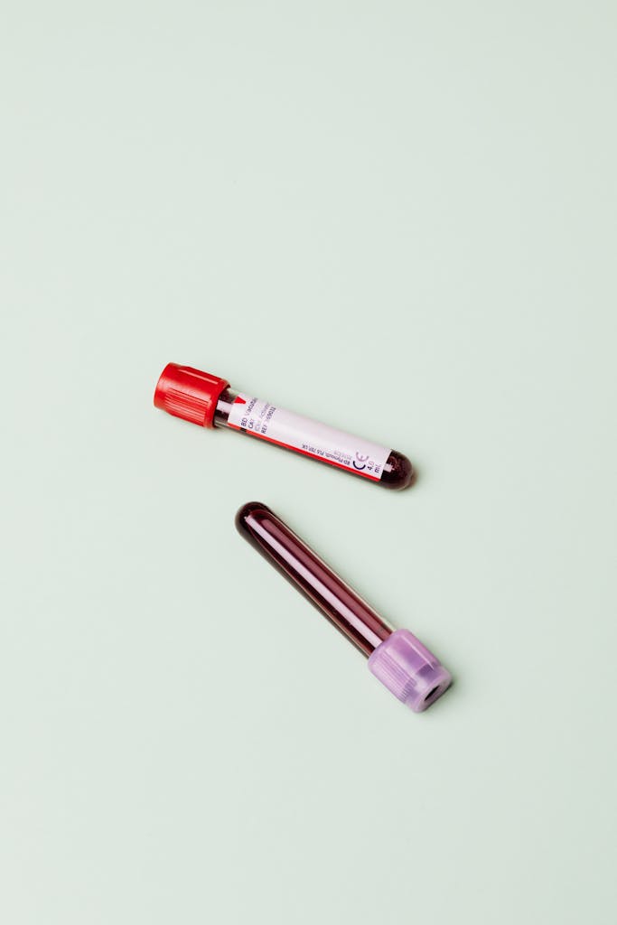 Two blood sample test tubes on a light background, ideal for medical research visuals.